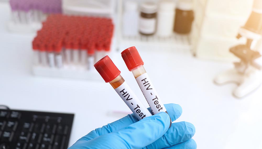 A close-up of a gloved hand holding two vials labeled "HIV test."