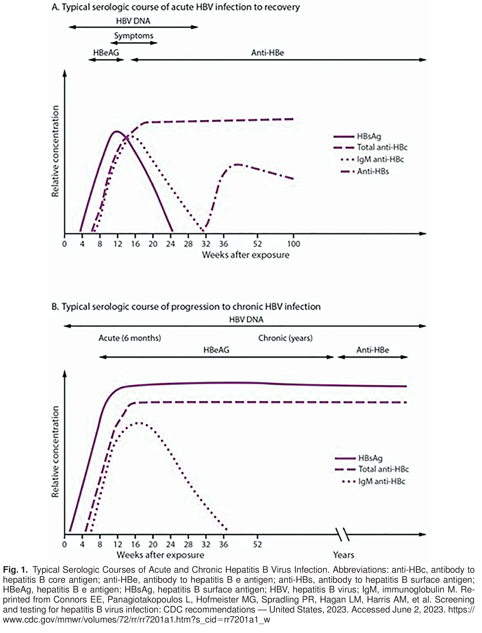 Fig. 1. Typical Serologic Courses of Acute and Chronic Hepatitis B Virus Infection. Abbreviations: anti-HBc, antibody to hepatitis B core antigen; anti-HBe, antibody to hepatitis B e antigen; anti-HBs, antibody to hepatitis B surface antigen; HBeAg, hepatitis B e antigen; HBsAg, hepatitis B surface antigen; HBV, hepatitis B virus; IgM, immunoglobulin M. Reprinted from Connors EE, Panagiotakopoulos L, Hofmeister MG, Spradling PR, Hagan LM, Harris AM, et al. Screening and testing for hepatitis B virus infection: CDC recommendations — United States, 2023. Accessed June 2, 2023. 
 https://www.cdc.gov/mmwr/volumes/72/rr/rr7201a1.htm?s_cid=rr7201a1_w 