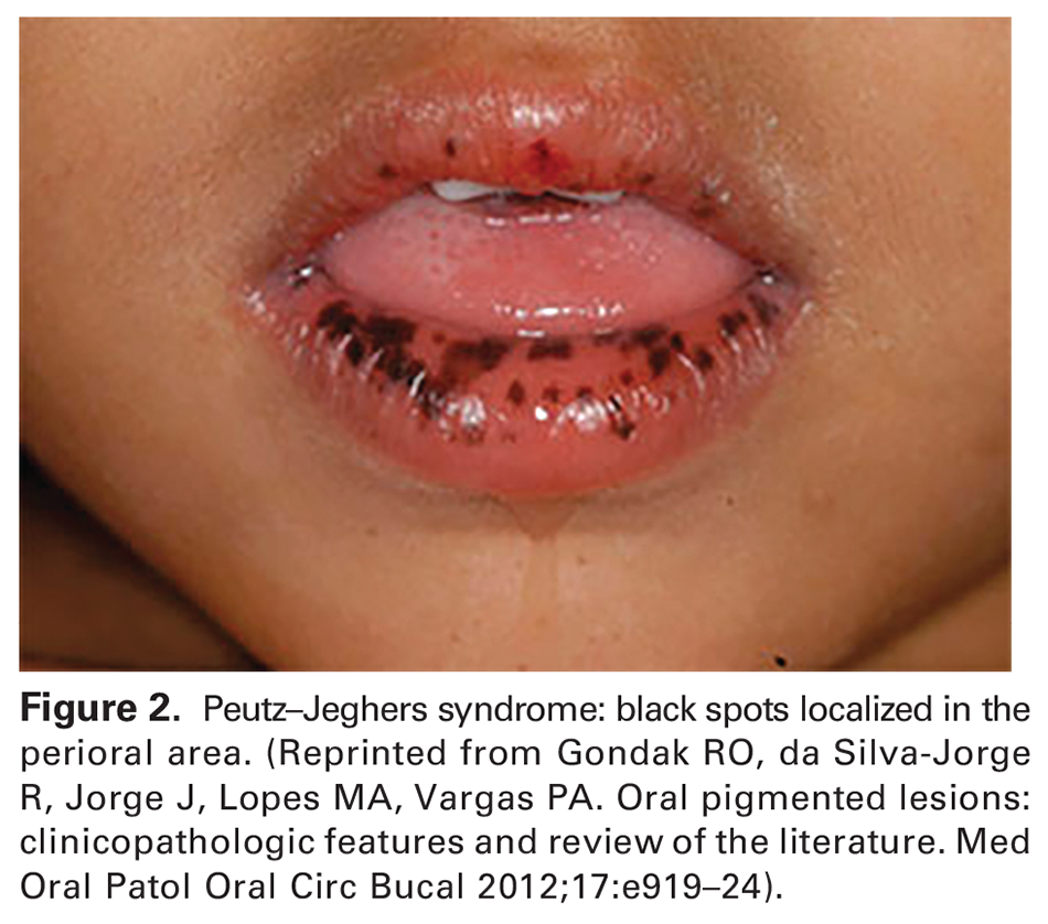 Hereditary Cancer Syndromes and Risk Assessment
