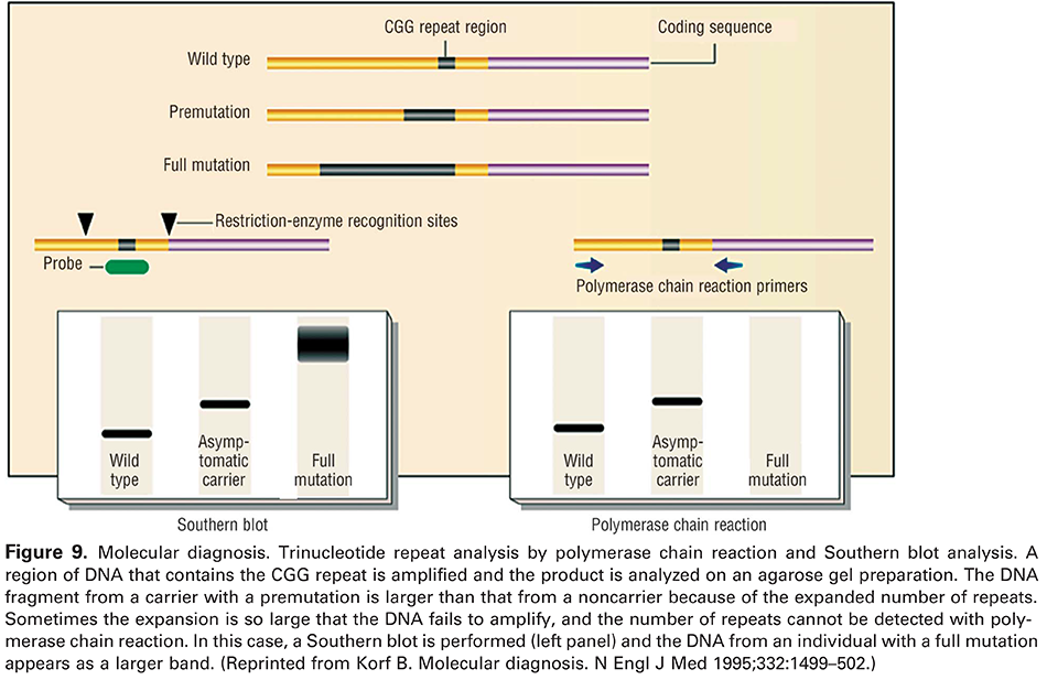 Figure 9. Molecular diagnosis. Trinucleotide repeat analysis by polymerase chain reaction and Southern blot analysis. A region of DNA that contains the CGG repeat is amplified and the product is analyzed on an agarose gel preparation. The DNA fragment from a carrier with a premutation is larger than that from a noncarrier because of the expanded number of repeats. Sometimes the expansion is so large that the DNA fails to amplify, and the number of repeats cannot be detected with polymerase chain reaction. In this case, a Southern blot is performed (left panel) and the DNA from an individual with a full mutation appears as a larger band. (Reprinted from Korf B. Molecular diagnosis. N Engl J Med 1995;332:1499–502.) 