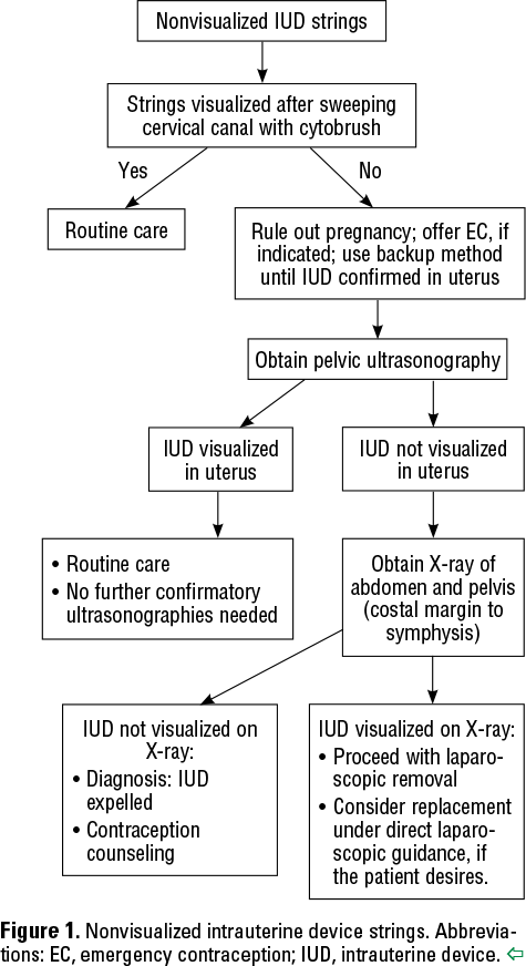 Figure 1. Nonvisualized intrauterine device strings. Abbreviations: EC, emergency contraception; IUD, intrauterine device. 